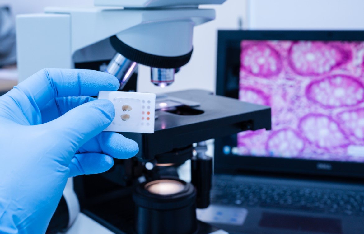 Anatomía patológica